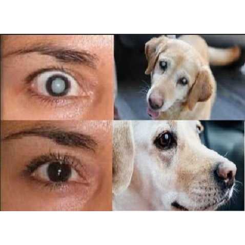 Cataract Eye Drops 4% NAC 2 x 10ml N2155